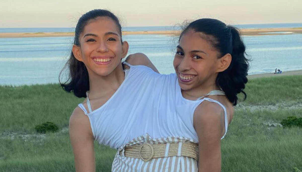 Siamesiske tvillinger og ekteskap med Daniel McCormack