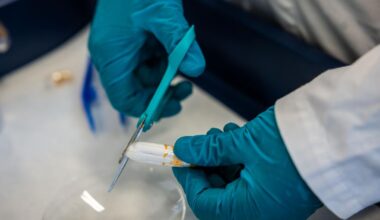 – Jenter så unge som tolv år bruker tamponger