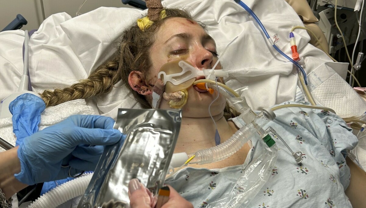 Graviditet reddet livet til Kate etter alvorlig bilulykke