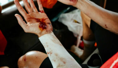 Blodig punktum - Dagbladet