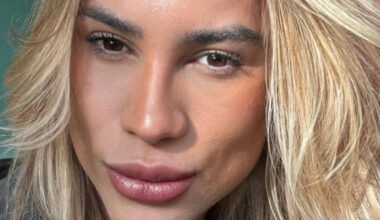 Den brasilianske influenseren Junior Dutra (31) døde etter ansiktsoperasjon