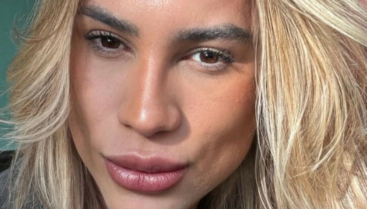 Den brasilianske influenseren Junior Dutra (31) døde etter ansiktsoperasjon