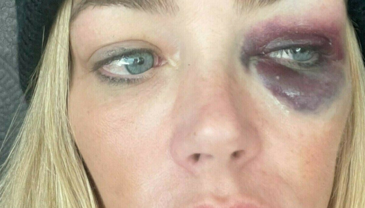 Denise Richards anklager Aaron Phypers for vold og trusler: Møtes i retten