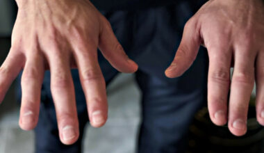 Lever i frykt etter skytingen