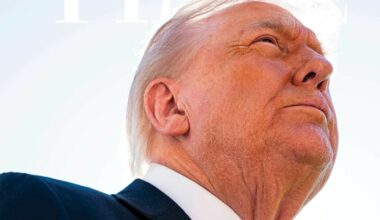 Raser: - De «fjernet» håret mitt