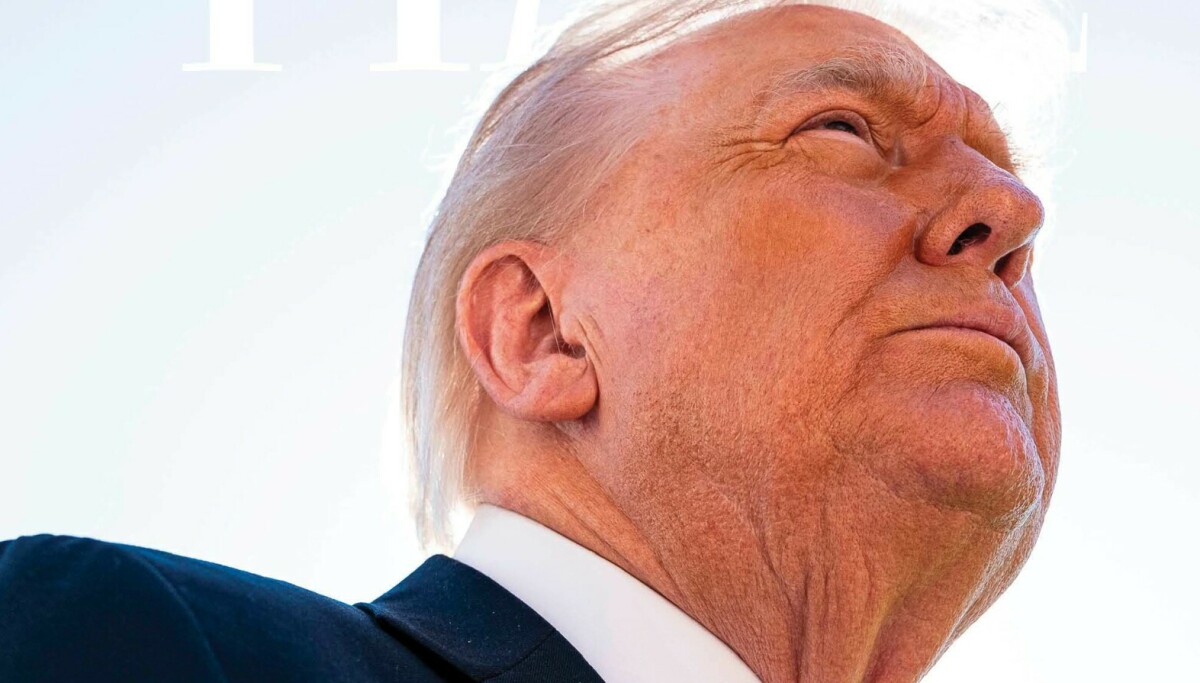 Raser: - De «fjernet» håret mitt