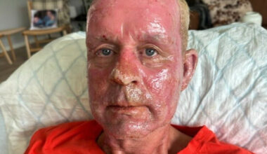 - Gjorde en klar feilvurdering