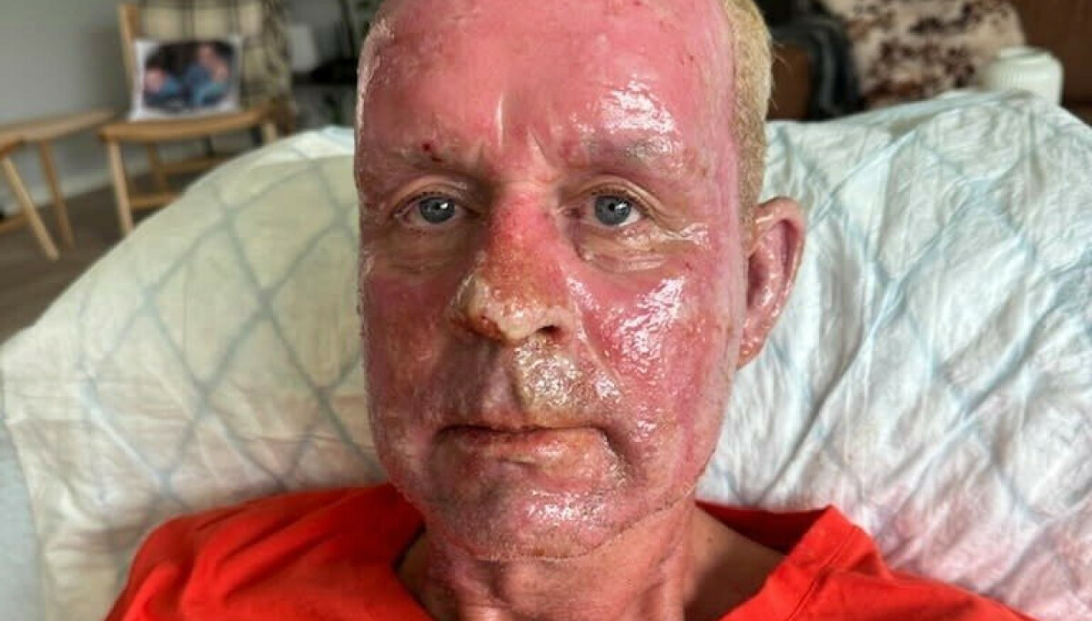 - Gjorde en klar feilvurdering