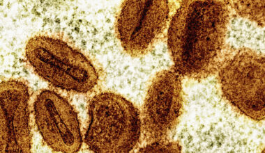 WHO slår alarm: - Svært bekymringsfullt