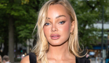 Sophie Elise fjerner rumpeimplantater etter ti år: Advarer mot trendbaserte operasjoner