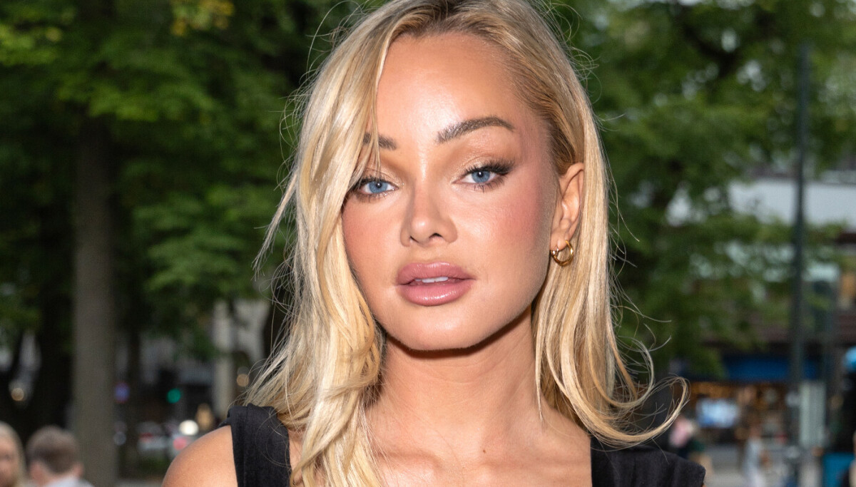 Sophie Elise fjerner rumpeimplantater etter ti år: Advarer mot trendbaserte operasjoner