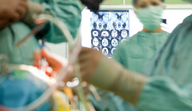 Østerriksk kirurg anklaget for å la datter bore i pasients hodeskalle