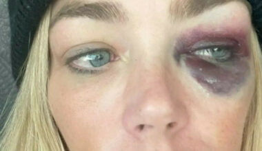 Hardt ut: - Falske bevis