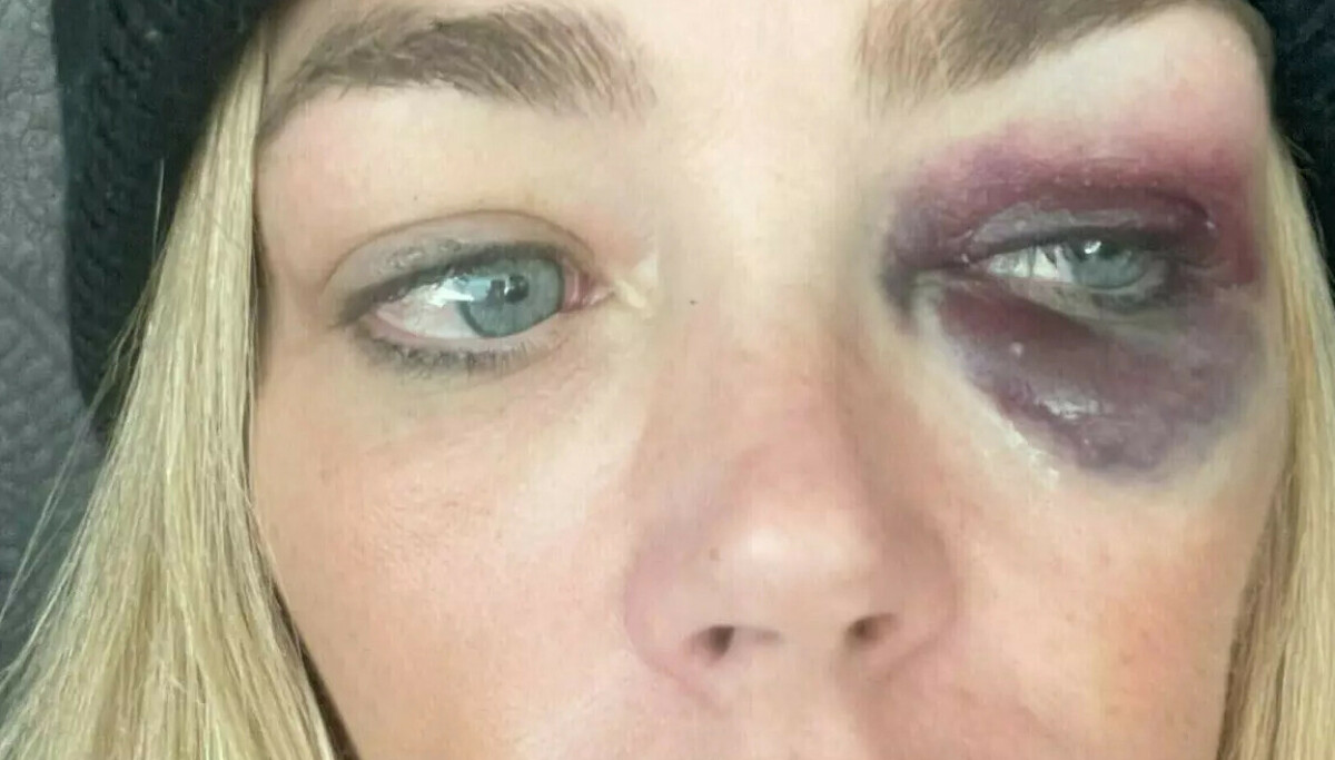 Hardt ut: - Falske bevis