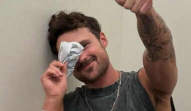 Dylan Efron skadet under «Dancing with the Stars», sendt til akutten