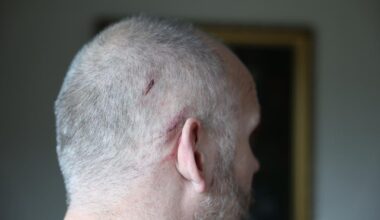 Pall Ingvarsson truffet av tre i stormen