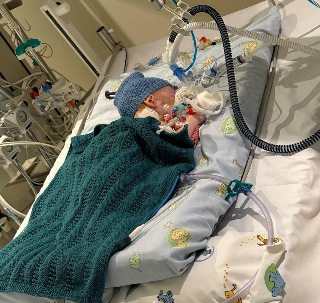 – Norske barn beskyttes ikke mot RS-virus