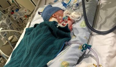 – Norske barn beskyttes ikke mot RS-virus