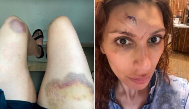 Sara Khorami i ulykke på settet: