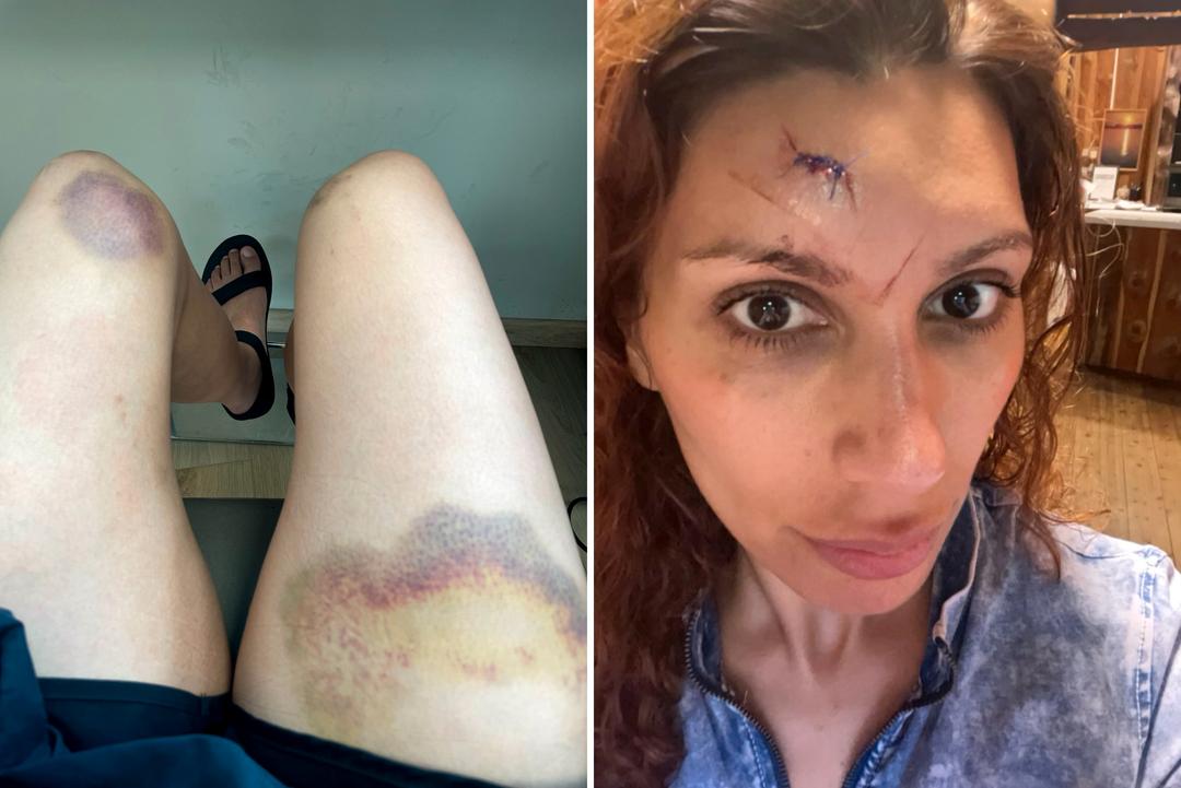 Sara Khorami i ulykke på settet: