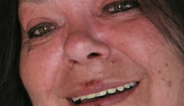 «Charterfeber»-Gry gikk ned 48 kilo på seks måneder