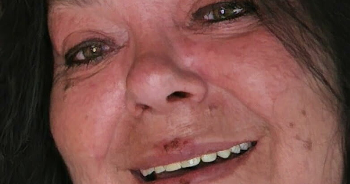 «Charterfeber»-Gry gikk ned 48 kilo på seks måneder