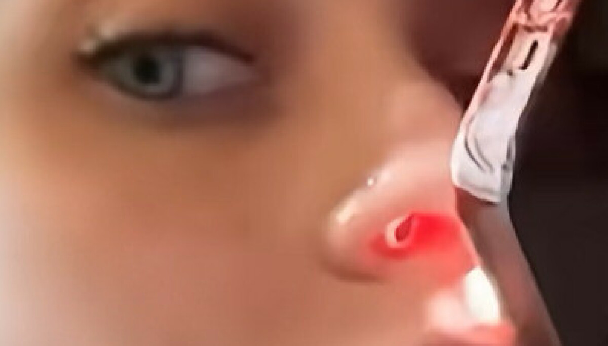 Paris Jackson avslører rusmisbrukets konsekvenser: Hull i neseskilleveggen