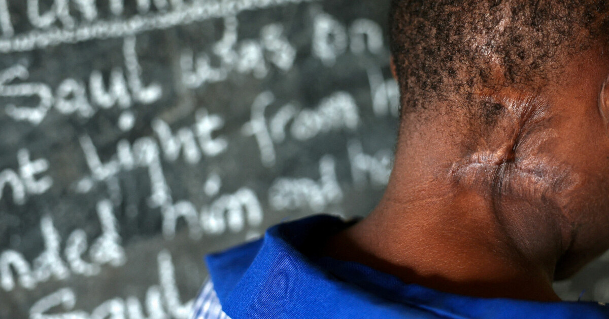 Ble anklaget for å være heks: