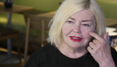 Unni Askeland: Innlagt etter akutt virus: