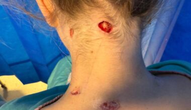 Svenske Naemi angrepet av løve