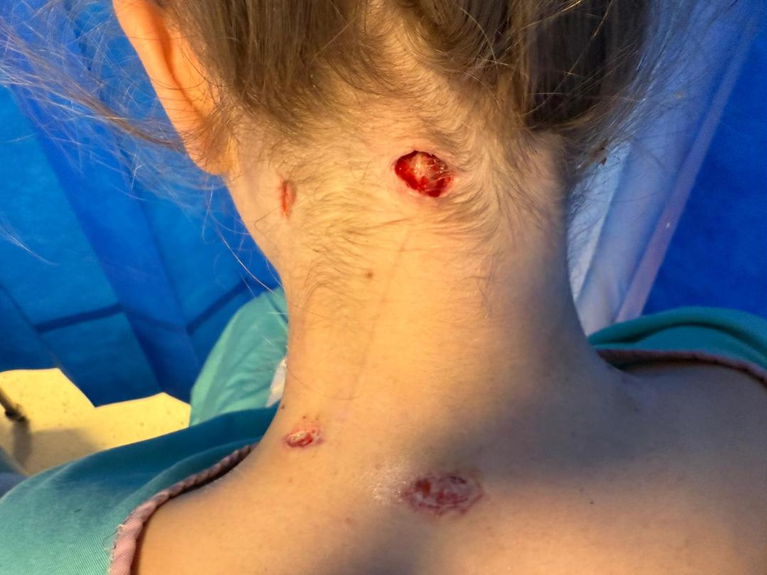 Svenske Naemi angrepet av løve