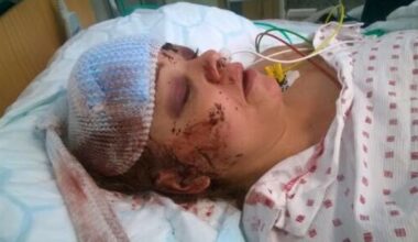 - Bare flaks at jeg overlevde kollisjonen med elgen