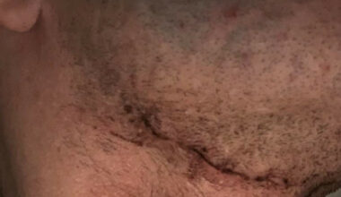 - Jeg var klinisk død i 17 sekunder