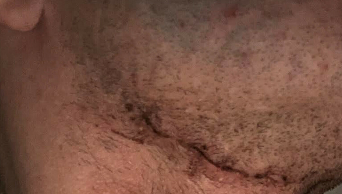 - Jeg var klinisk død i 17 sekunder