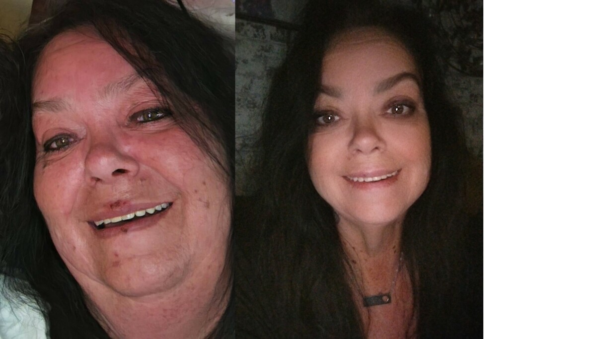 Gikk ned nesten 50 kilo på seks måneder