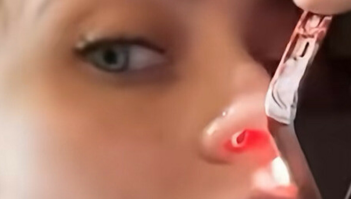 Paris Jackson avslører rusmisbrukets konsekvenser: Hull i neseskilleveggen