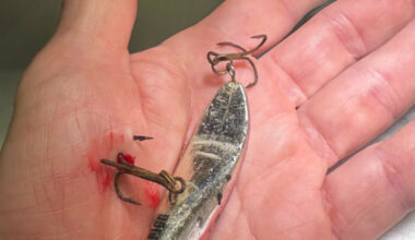 Bård Tufte Johansen avslører dramatisk ulykke før showet