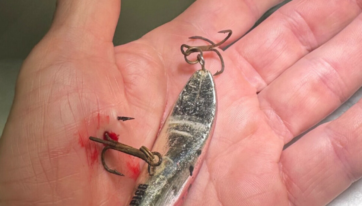 Bård Tufte Johansen avslører dramatisk ulykke før showet