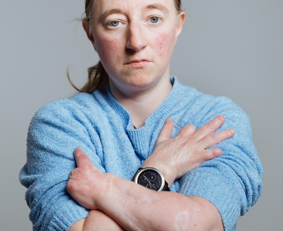 Regjeringen kutter støtte til sårbare tannpasienter