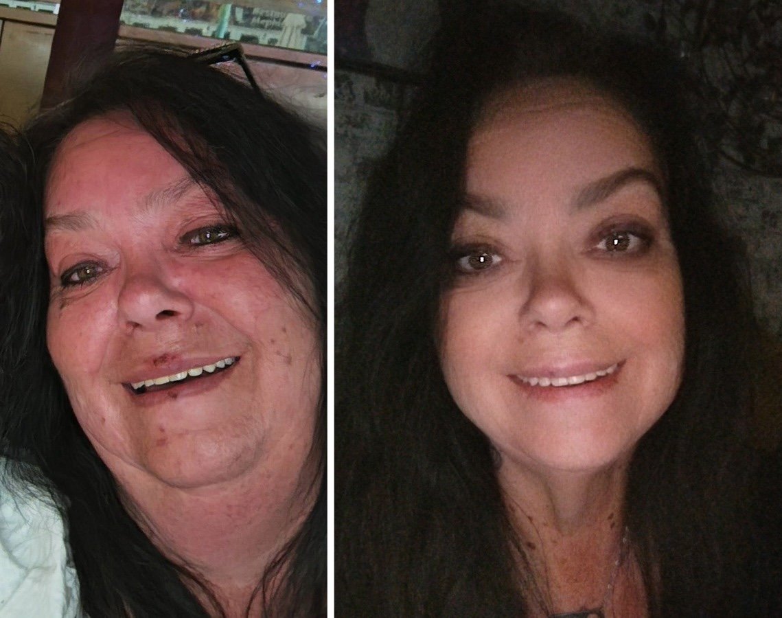 Charterfeber, Eiker | TV-profilen får massiv oppmerksomhet etter vekttapet: – Skjønner det ikke