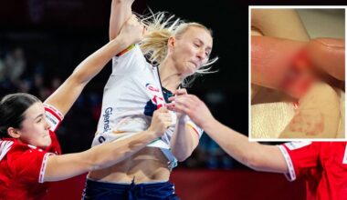 Henny Reistad med et bilde av en skadet finger innfelt