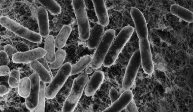 Et svart hvitt mikroskopisk bilde av salmonella angrepet av bakteriofager