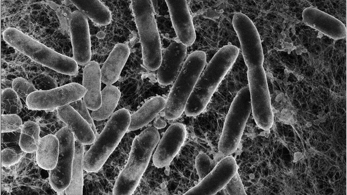 Et svart hvitt mikroskopisk bilde av salmonella angrepet av bakteriofager