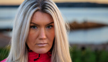 Lotte Hoel fra «Spillet» har de kroniske diagnosene endometriose og trigeminusnevralgi