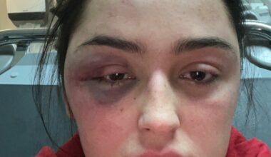 - Skulle ønske politiet tok meg seriøst første gang