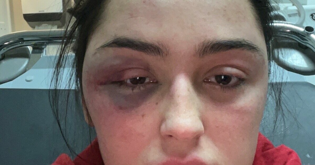 - Skulle ønske politiet tok meg seriøst første gang