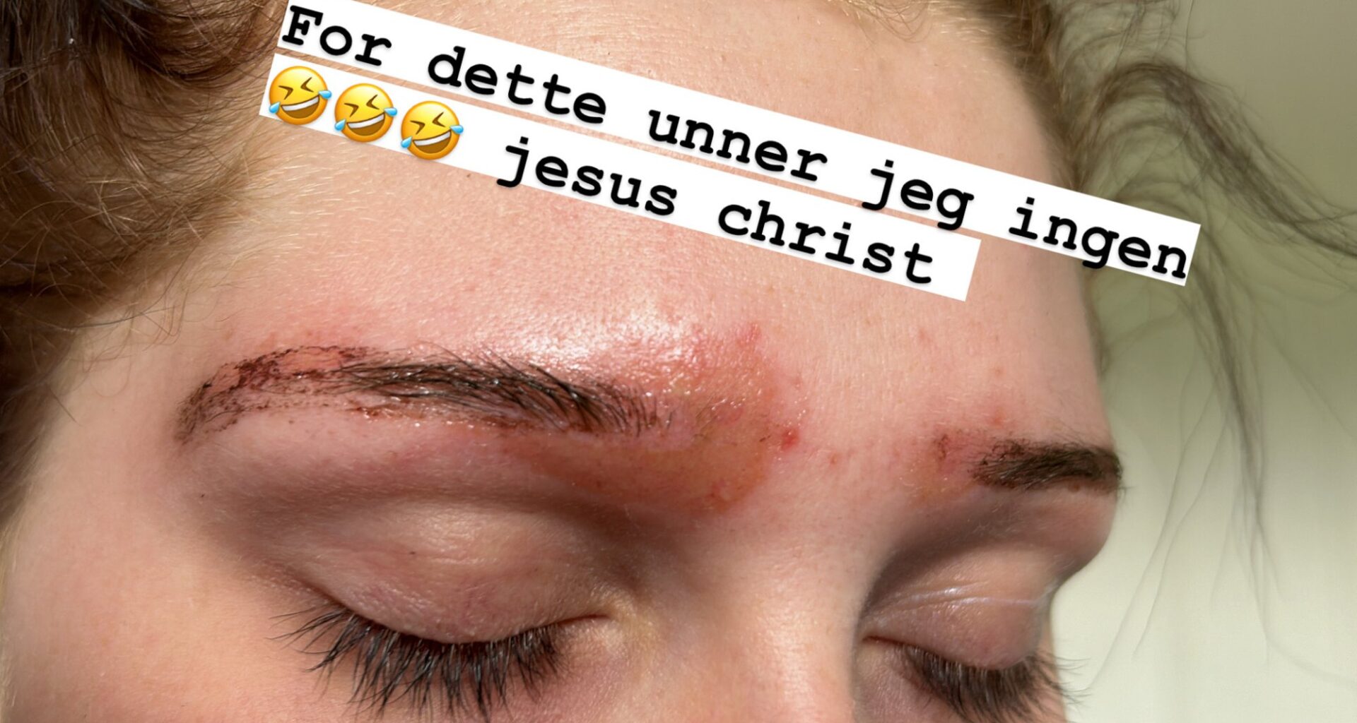 Lyko, Normal | Forbrukerrådet advarer mot vanlige Lyko og Normal-produkter: – Kjemisk forbrenning