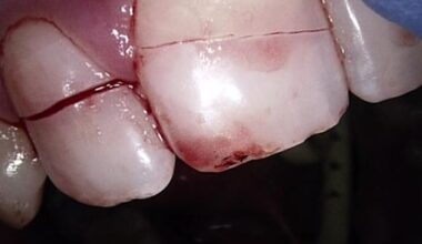 Oslo kommune tok ikke telefonen