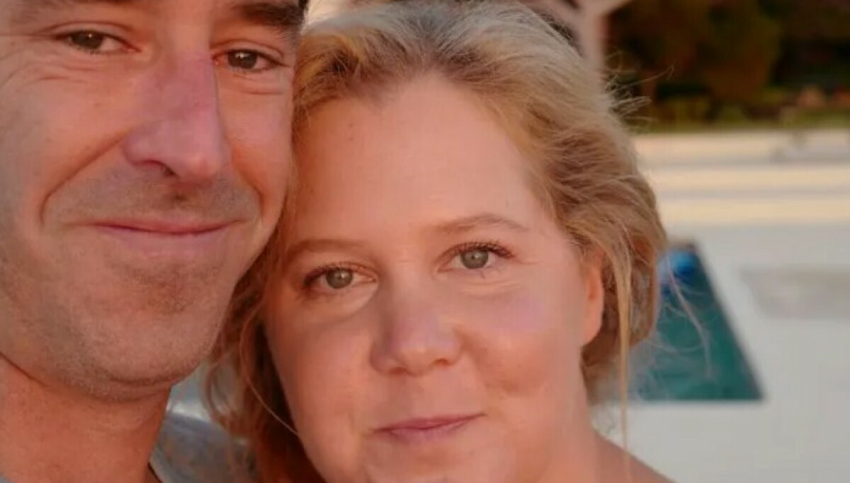Amy Schumer og Chris Fischer