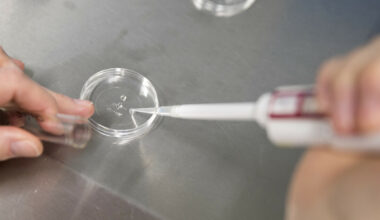 Dansk donor skaper sjokkbølger: Alvorlig genetisk mutasjon oppdaget